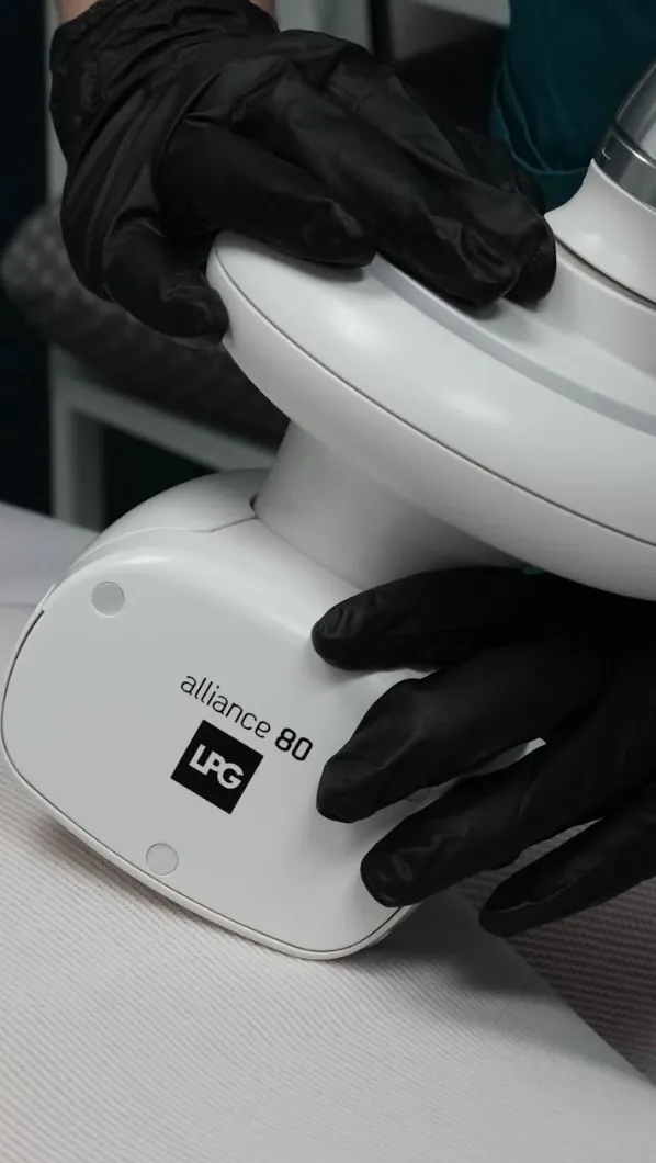 The LPG Alliance 80 handpiece