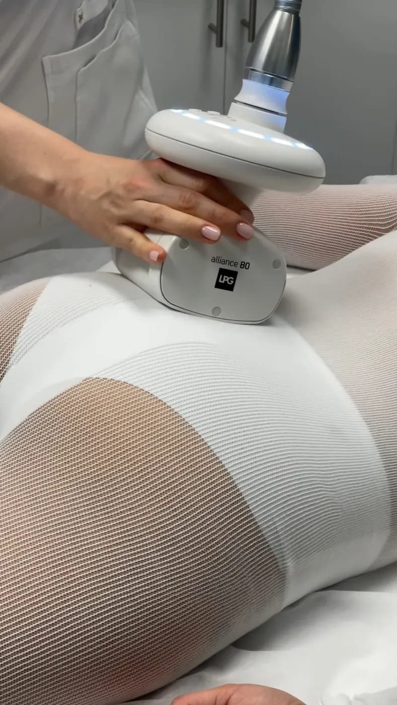 LPG Alliance device gliding over a client in a white LPG body suit