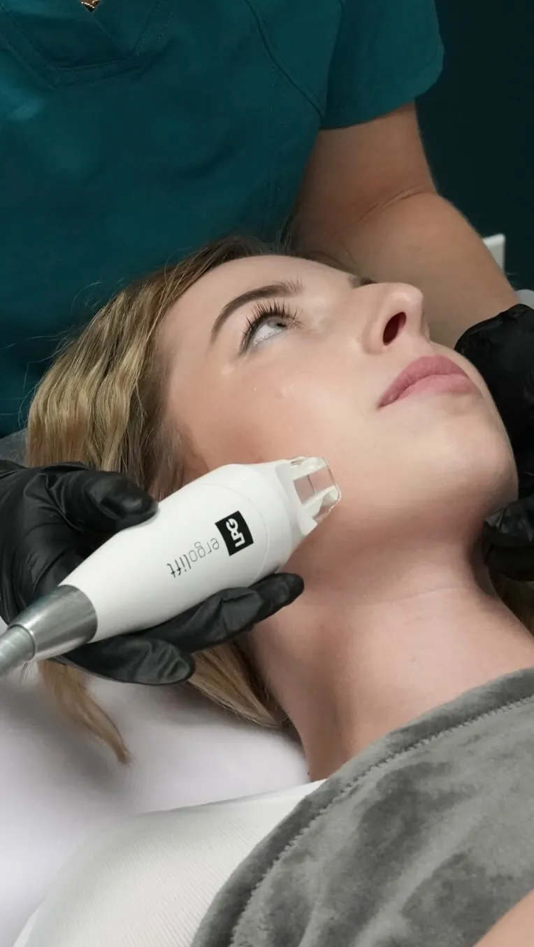 Close-up of an LPG face session on the cheek
